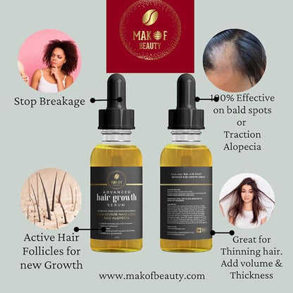 Effective Hair Growth Treatment: Biotin, Collagen, Protein and 38 Essential Oils for Longer, Thicker Hair. Moisturizes Scalp, Prevents Dandruff and Edges Loss. 60ML