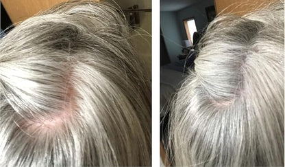 Caboki Hair Loss Concealer. All-Natural Hair Building Fiber. Make Thin Hair Look 10X Fuller Instantly. Eliminate the Appearance of Bald Spot and Thinning Hair (30G, 90-Day Supply). Gray