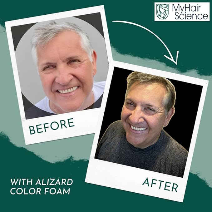 Alizard Natural Hair Color for Gray Hair | Gradual De-Graying Shampoo | Hydrolyzed Collagen & Allatonin | Not Hair Dye - Color Activation | Grey Hair Touch Up | Men & Women | Instant Results - Brown