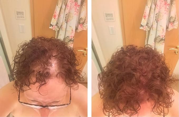 Caboki Hair Loss Concealer. All-Natural, Plant-Based Hair Building Fiber. Covers Bald Spot and Thinning Hair. Make Thin Hair Look 10X Fuller Instantly.(30G, 90-Day Supply). Light Auburn