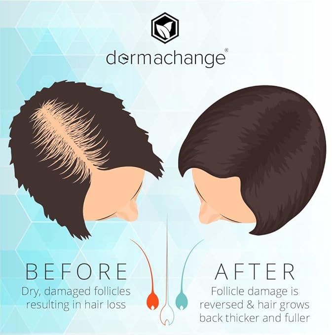 Hair Growth Shampoo for Thining and Hair Loss - Sulfate Free for Men and Women - Shinier, Volumizing and Thickening Shampoo for Color Treated Hair with Aloe Vera (16oz)