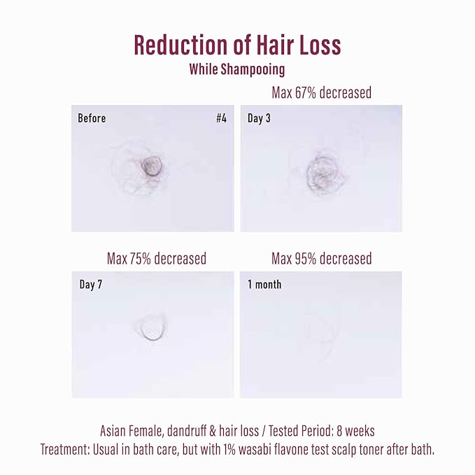 Moist Diane Hair Loss Treatments for Women & Men, Dry Itchy Scalp Treatment by Keratin, Argan Oil, Ginseng Root & Protein, Hair Thickening Conditioner from Japan, 15.2 Fl Oz, EXTRA HAIR FALL CONTROL