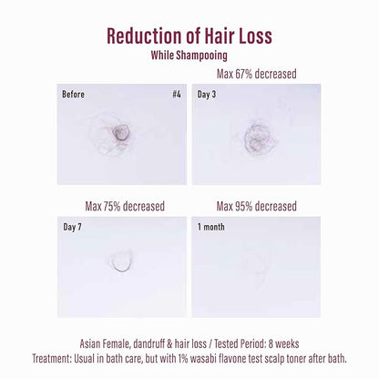 Moist Diane Hair Loss Treatments for Women & Men, Dry Itchy Scalp Treatment by Keratin, Argan Oil, Ginseng Root & Protein, Hair Thickening Conditioner from Japan, 15.2 Fl Oz, EXTRA HAIR FALL CONTROL