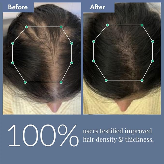 Anveya Rosemary Hair Growth Serum | Hair Serum for Hair Growth with Redensyl, Procapil, Anagain & Capilia Longa | Rosemary for Hair Growth | Best Hair Growth Serum & Hair Serum for Men & Women | 50ml