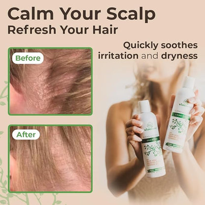 Eczema Psoriasis Shampoo & Conditioner Set for Men & Women - Anti Dandruff Shampoo for Dry Scalp & Hair - Seborrheic Dermatitis for Itchy Scalp Treatment - Eczema for Psoriasis