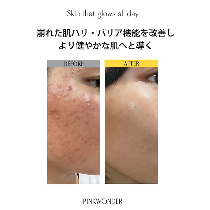 PINKWONDER USDA Organic Jojoba Oil (6.76oz, Jojoba Toner)