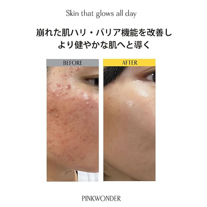 PINKWONDER USDA Organic Jojoba Oil (6.76oz, Jojoba Toner)