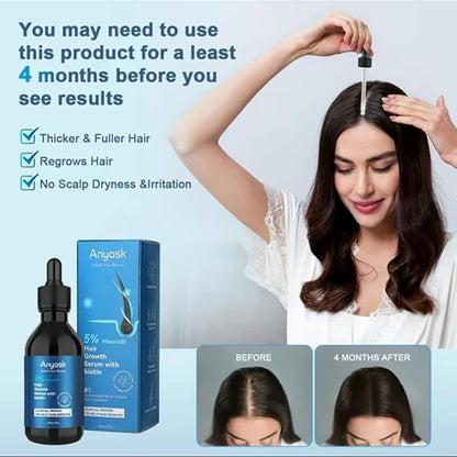 Anyash 5% Minoxidil Hair Growth Oil For Men and Women, Biotin Infused Serum For Hair Regrowth and Thinning, Natural Treatment for Thicker, Longer, Fuller, Healthier Hair, 60ml