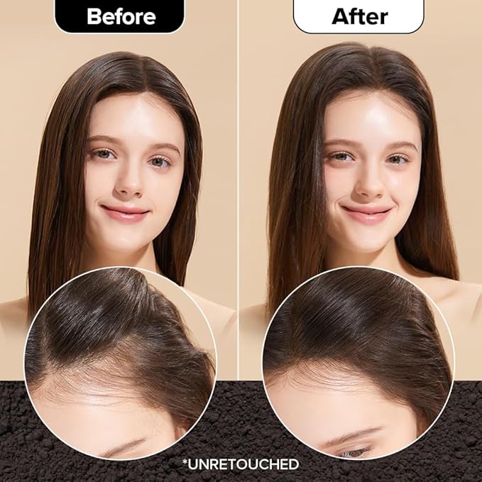 I DEW CARE Tap Secret Dry Shampoo Powder with Biotin - Tap Secret Original & Dark Brown Duo set | Strengthening & Volumizing, Powder Type, Refillable, Travel size, 0.24 Oz * 2ea