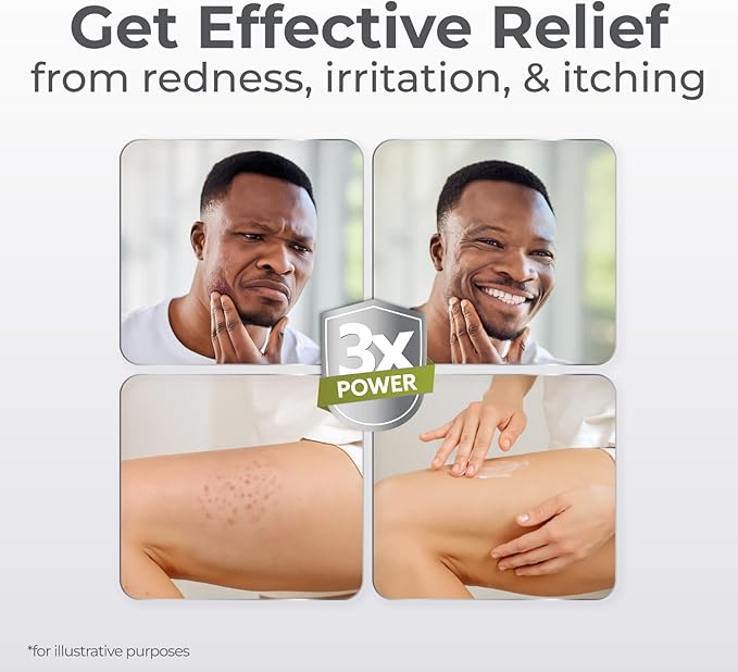 Terrasil Folliculitis Cream, Folliculitis Treatment of Ingrown Hair & Itching, Clinically Proven 1% Clotrimazole, Natural Ingredients, Scalp, Face & Body, Dermatologist Tested. (1.7 oz)