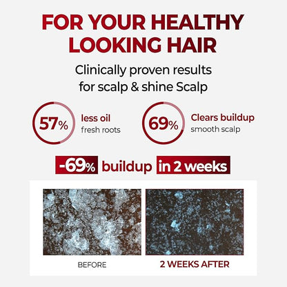 KUNDAL Korean Caffeine Scalp Shampoo [Baby Powder] – Sulfate-Free Hair Care with Menthol & Botanical Extracts – For Fuller-Looking Hair, Scalp Refresh & Strength – 16.9 Fl Oz