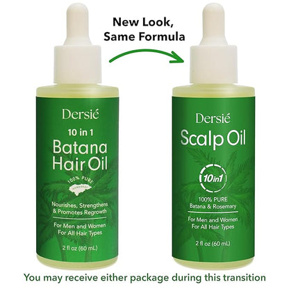 Scalp Oil for Hair Loss & Thinning Hair: Stimulates Follicles and Nourishes Scalp with Batana, Rosemary & Tea Tree – Ideal for Coily, Curly, Dry & Damaged Hair – Soothes Dry, Itchy, Flaky Scalp (60mL)