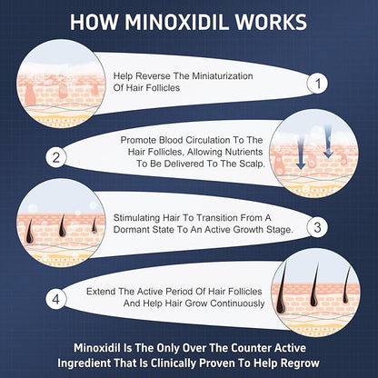 4 Packs Minoxidil Foam, 5% Minoxidil for Men and Women, Infused with Biotin, Hair Growth Treatment, Supports Thicker and Fuller Hair & Beard, Upgraded version (Minoxidil Foam 8.44Oz, 4-Month Supply)