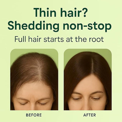 LUSTEL Rosemary Strengthening Volumizing Shampoo and Conditioner Set for Thinning Hair - Sulfate Free - Biotin Shampoo with Tea Tree & Mint. For All Hair Types - 16 Fl Oz Each (2-Pack)