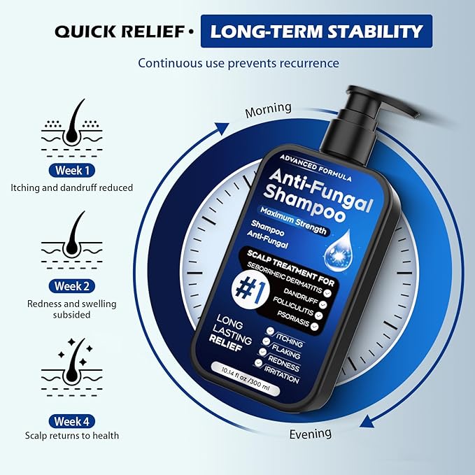 Antifungal Shampoo for Seborrheic Dermatitis, Folliculitis & Scalp Psoriasis, Anti-Dandruff Shampoo for Men & Women, Relieves Scalp Itching, Dryness, Sulfate & Paraben-Free, 10.1 Fl Oz