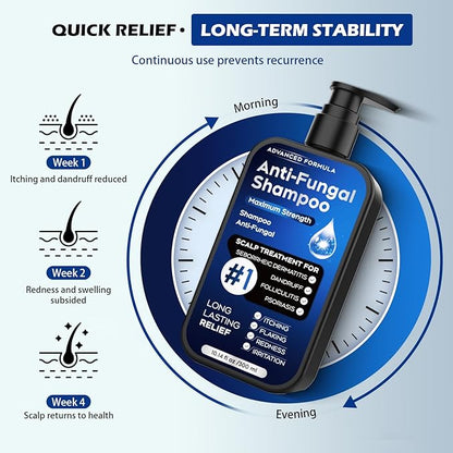 Antifungal Shampoo for Seborrheic Dermatitis, Folliculitis & Scalp Psoriasis, Anti-Dandruff Shampoo for Men & Women, Relieves Scalp Itching, Dryness, Sulfate & Paraben-Free, 10.1 Fl Oz