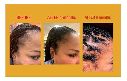 GOOD2GRO Hair Resuscitator with SureGro - 4oz | Repairs, Restores & Regrows Hair | Root-Activating with Tingling Sensation for Healthy Follicle Growth | Vegan & Cruelty-Free