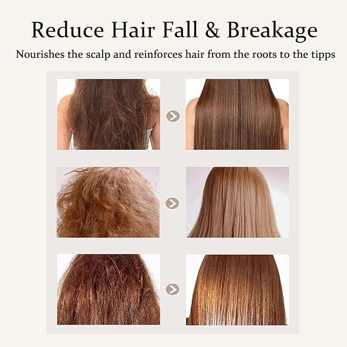Tricholoy Anti-Hair Fall & Less Shedding & Volumizing Shampoo, Enriched with biotin, arginine, and lauric acid, Oil Control & Scalp Nourishment, Strengthens Roots, Promotes Hair Growth (1)