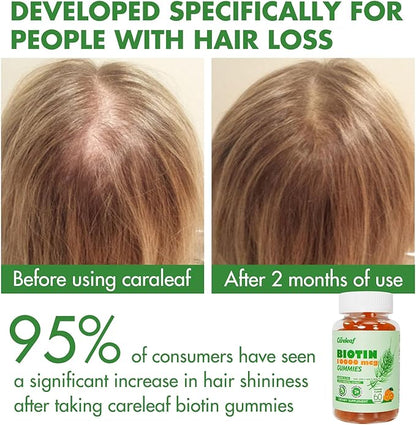 Biotin Gummies, Hair Growth Gummies with 10000 mcg Biotin/Collagen/Keratin, Hair Vitamins for Fuller Hair, Stronger Nails, Glowing Skin, Beauty Support for Women, 60 Count, Orange Flavor