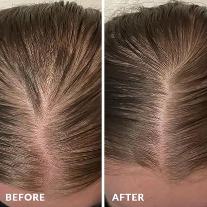 Rosemary Rice Water Shampoo Conditioner & leave-in Spray for Hair Growth Repair System Kit, w/Rosemary, Biotin, Caffeine, Sulfate Free Routine Shampoo for Women Men Hair Loss Thickening