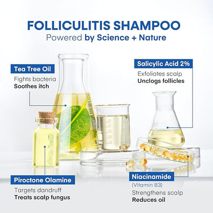 Hermon Folliculitis Shampoo for Itchy Scalp: Psoriasis, Dandruff & Seborrheic Dermatitis & Biotin – Soothes | Exfoliates | Reactivates Follicles