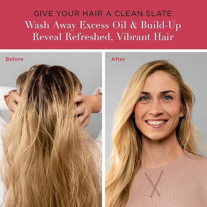 unwash Anti Residue Hair Cleanser: Gentle pH Balanced Clarifying Shampoo, Removes Build-up, Moisture Balancing, Hair Detox, 2.5 Fl oz (1 Pack)