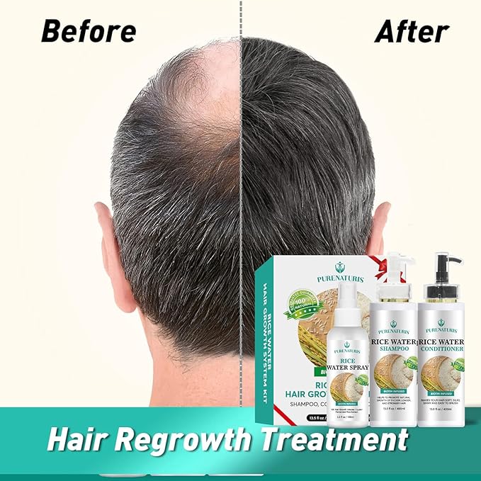 Rosemary Rice Water Shampoo Conditioner & leave-in Spray for Hair Growth Repair System Kit, w/Rosemary, Biotin, Caffeine, Sulfate Free Routine Shampoo for Women Men Hair Loss Thickening
