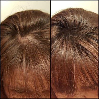 Caboki Hair Building Fiber. (30G, 90-Day Supply). Auburn