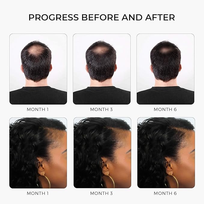 Premium Hair Strengthening Shampoo Castor Oil, Biotin, Avocado Oil, Caffeine, Saw Palmetto, Onion, and Redensyl Hair Regrowth & Thickening Support Sulfate-Free, Paraben-Free, for Men & Women