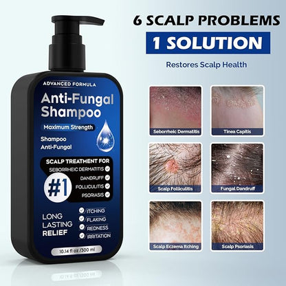 Antifungal Shampoo for Seborrheic Dermatitis, Folliculitis & Scalp Psoriasis, Anti-Dandruff Shampoo for Men & Women, Relieves Scalp Itching, Dryness, Sulfate & Paraben-Free, 10.1 Fl Oz
