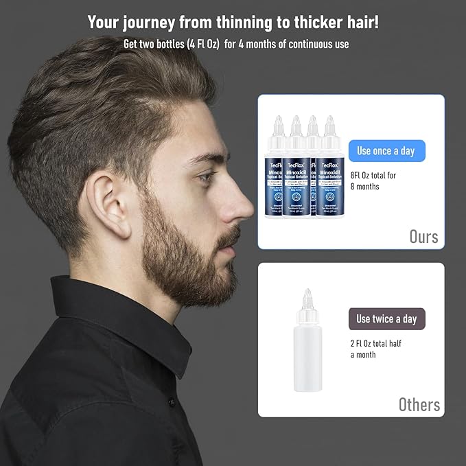 5% Minoxidil for Men Hair with Biotin, Minoxidil for Women,Tecflox Minoxidil Beard Growth Oil, Minoxidil Hair Growth Serum for Men,4-Pack,Total 8Fl Oz for 8 Months, Hair Growth Oil(White)