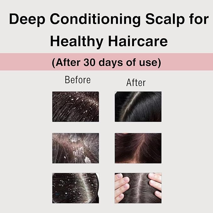 Moist Diane Keratin Hair Treatment for Dry Hair & Damaged Hair Women and Men, Organic Hair Care with Argan Oil & Cherry Blossom Extracts from Japan, Sulfate & Silicone Free, EXTRA VITAL, 15.2 Fl Oz