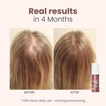 Hair Helper+ Spray - Growth Serum With Biotin & Castor Oil made in USA - Caffeine Infused Treatment for Thicker, Fuller Hair - Repair Thinning Naturally - Vegan, Cruelty-Free Formula