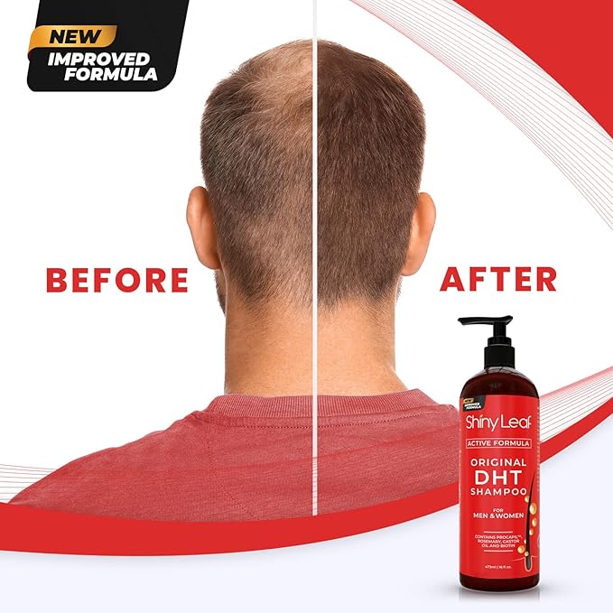 DHT Blocker Shampoo and Conditioner for Hair Loss With Biotin For Men, Women, Anti-Hair Loss Treatment, Rosemary Leaf Oil and Asparagus Extracts, for Thinning Hair (Shampoo and Conditioner) (1 Set)
