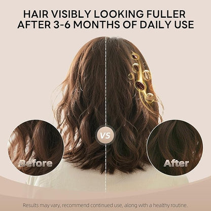 Alfheim Coffee+ Thickening Shampoo | Caffeine, Biotin & Niacinamide for Hair Growth & Strength | Volumizing & Hydrating Formula for Thinning & Fine Hair | Sulfate-Free, Color-Safe -18oz