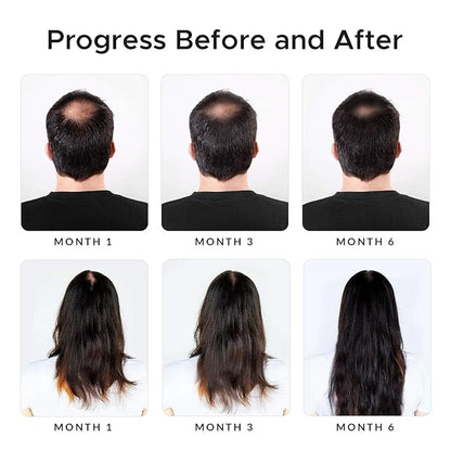 Minoxidil & Biotin Shampoo for Hair Growth - Enriched with Caffeine, Castor Oil & Onion - DHT Blocker for Thicker, Healthier Hair - Strengthening Formula for Men & Women