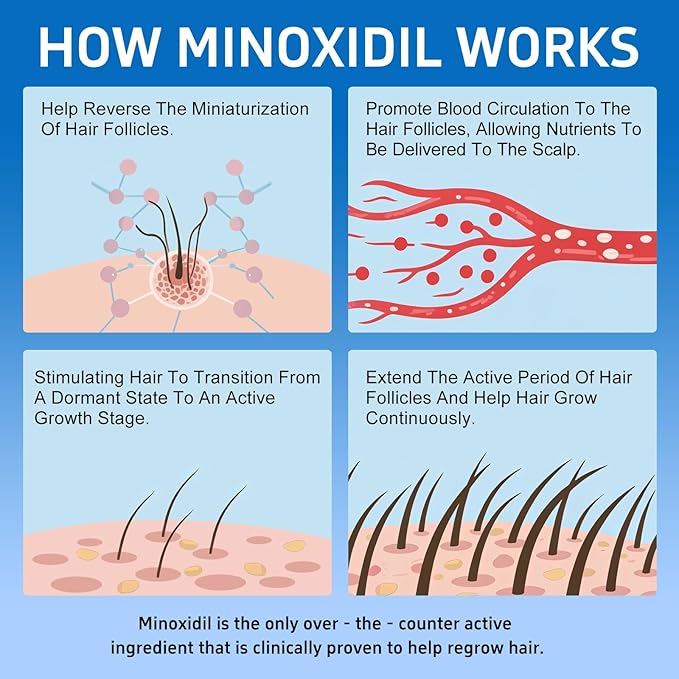 6 Packs, 5% Minoxidil with Biotin, Hair Growth Treatment, Minoxidil Hair and Beard Growth Oil, Minoxidil for Men and Women, Supports Thicker and Fuller Hair & Beard (12 fl oz, 6 Month Supply)