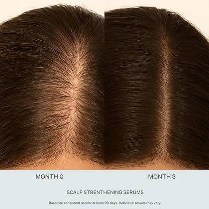Multi-Peptide Serum for Men & Women - Helps Reduce Hair Loss - Strengthens & Thickens - Plant-Based - Combats Thinning Hair - Healthy Longer Hair - Root Awakening Morning (AM) - 28ml