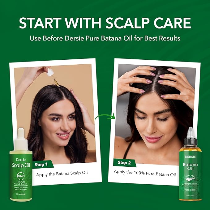 Scalp Oil for Hair Loss & Thinning Hair: Stimulates Follicles and Nourishes Scalp with Batana, Rosemary & Tea Tree – Ideal for Coily, Curly, Dry & Damaged Hair – Soothes Dry, Itchy, Flaky Scalp (60mL)