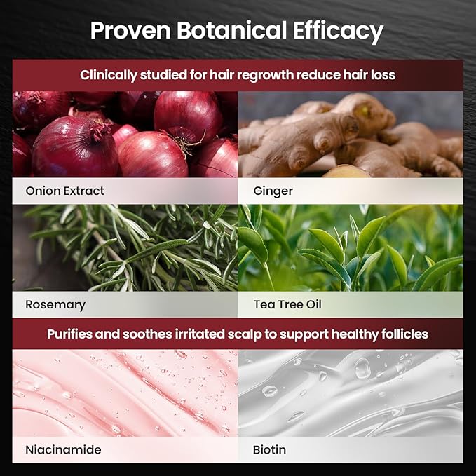 Onion & Biotin Hair Growth Shampoo: Infused With Natural Rosemary Tea Tree Oil Anti Hair Loss Treatment - Scalp Smooths Thickening Formula Support Hair Regrowth For Women Men 12.5Fl Oz