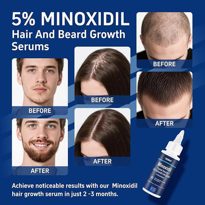 5% Minoxidil with Biotin, Hair Growth Treatment, Minoxidil Hair and Beard Growth Oil, Minoxidil for Men and Women, Supports Thicker and Fuller Hair & Beard (4 fl oz, 2 Month Supply)