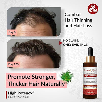 High Potency® Hair Growth Oil – Hair Defence Pro Formula | 20% Clinically Proven Actives including Procapil, Redensyl, Capilia Longa, Rosemary, Saw Palmetto, Jojoba, Pumpkin Seed Oil