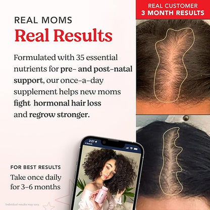 HAIRtamin MOM Vegan Prenatal & Postnatal Multivitamin Supplement & Hair Vitamin Pregnancy, Postpartum, Breastfeeding Probiotic One-a-Day Hair Vitamins with Biotin, Zinc, Iron (30 Counts)