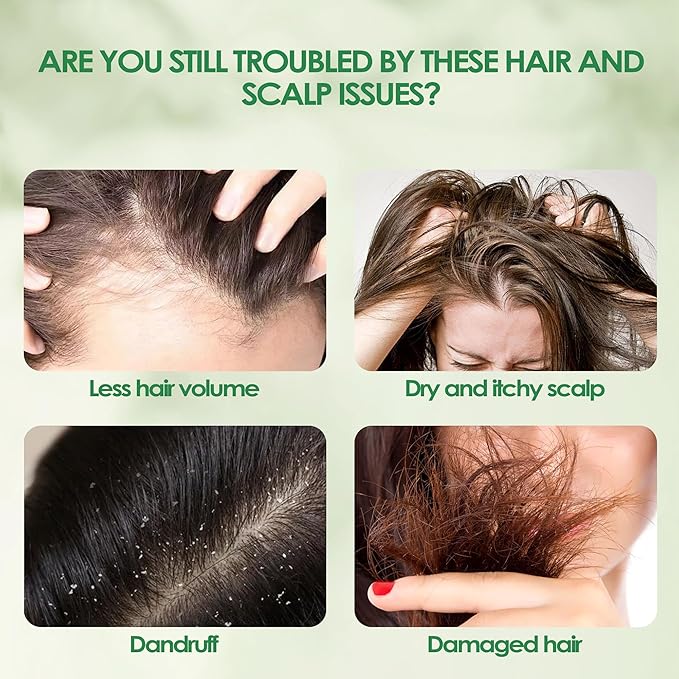 Hair Camp Oil for Hair Growth, with Black Seed Extract + Rosemary, Infused with Tea Tree Oil for Strengthening, Soothing, Moisturizing & Healthier Hair, 120ml (1)