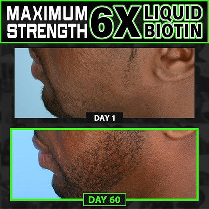 Beard Growth Kit w/ 2X Thickening Biotin Beard Balm/Beard Care & Beard Conditioner + 6X Liquid Biotin with Collagen Peptides for Beard & Hair Growth