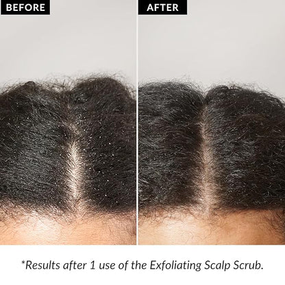 Love Ur Curls Exfoliating Scalp Scrub, Moisturizing, Gentle Build Up Removal for Curly Hair - with Peppermint Oil, for Alll Curl Types, 150mL