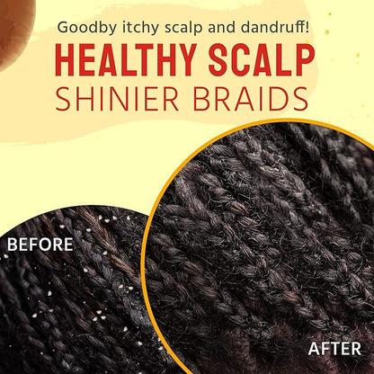 Glammed Naturally - Braid Oil for Itchy Scalp and Dry Scalp, Braid Care Oil for Dandruff, Lice and Thinning Edges, 2 oz