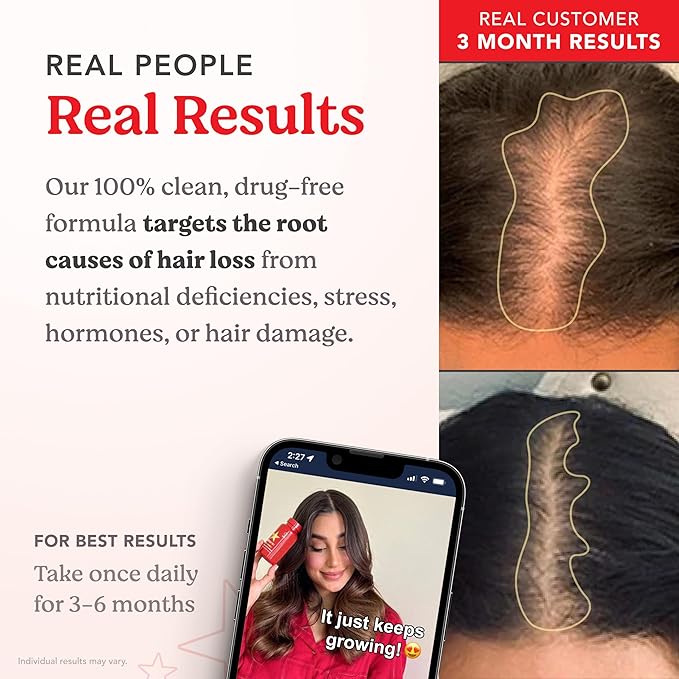 HAIRtamin Advanced Formula Hair Growth Supplement for Women & Men, Supports Stronger, Longer, Visibly Thicker Hair, With 5000 mcg Biotin, Vitamins & Antioxidants, 100% Vegan – 1 Month Supply