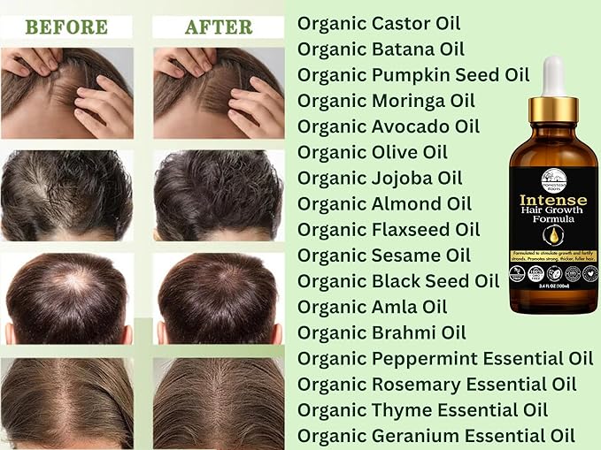 Intense Hair Growth Oil - Organic - Blend of 17 Oils (Batana, Castor & Rosemary) – Supports Thicker, Fuller Hair (1.7 oz)