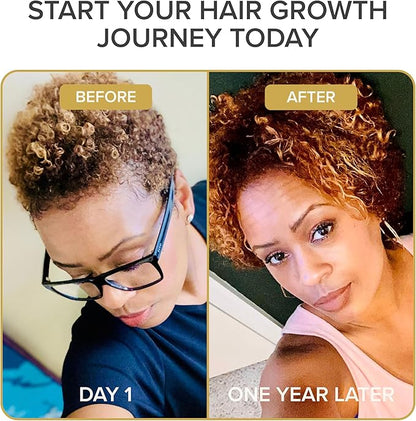 Iconic Natural Hair Vitamins for Fast Hair Growth, Pure Hair Supplements Formulated with Vitamins to Promote Thicker, Stronger Hair - Vegan Hair Care for Hair Loss - (60 Capsules(Pack of 1))